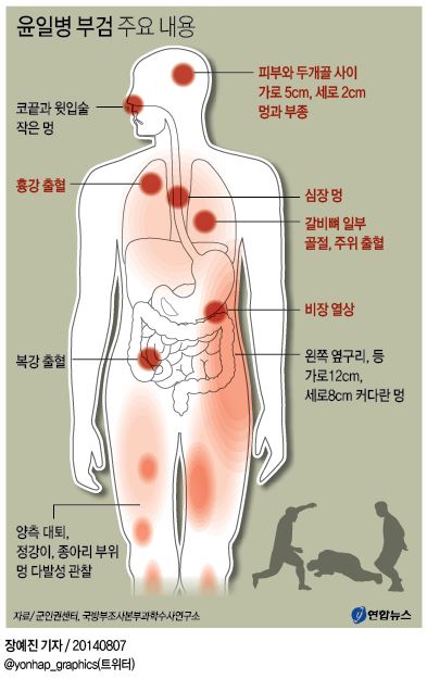 <그래픽> 윤일병 부검 주요 내용