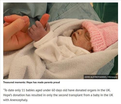출생 1시간만에 세상 떠난 아기, 최연소 장기기증 - 2