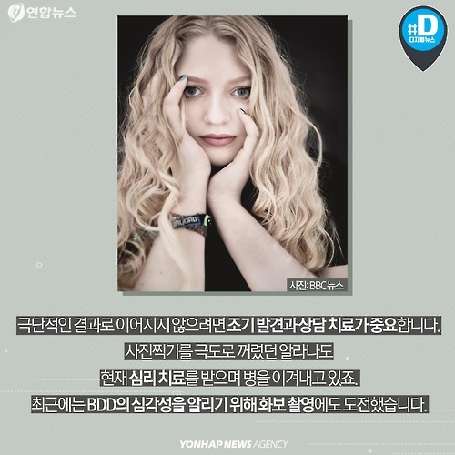 <카드뉴스> "내 얼굴이 싫어요" BDD 증후군, 들어보셨나요? - 9