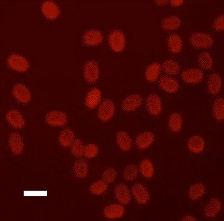 탄저균 포자 최외각층 포함된 RNA(빨강)