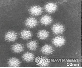 전자 현미경으로 관찰된 노로 바이러스