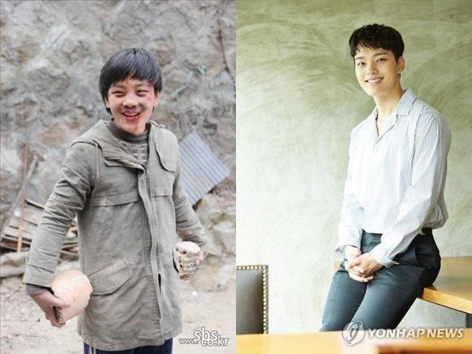 2010년 SBS '자이언트'의 여진구(왼쪽)와 현재 tvN '써클'의 여진구