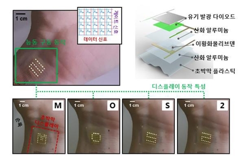 피부 위에서 안정적으로 작동하는 초박막 디스플레이
