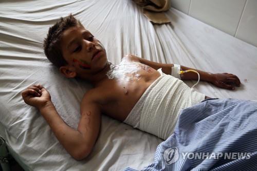 아프간 독립기념일에 발생한 연쇄 폭탄테러로 다친 아이