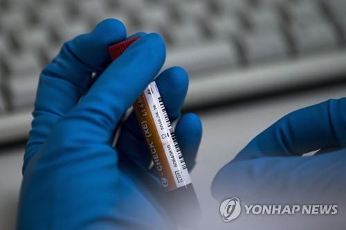 도핑테스트 샘플