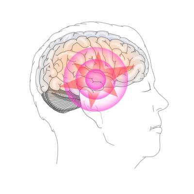 외상후 스트레스 장애(PTSD)