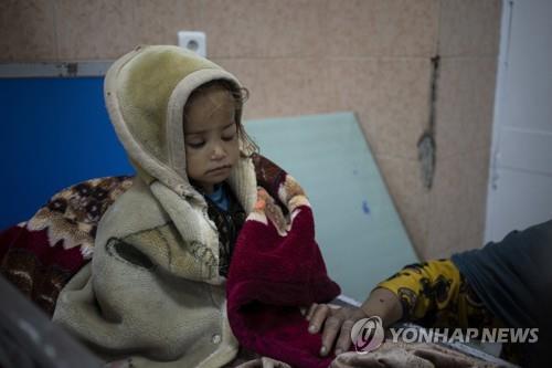 영양실조로 카불 어린이병원 입원 두 살배기…눈뜰 힘도 없어 