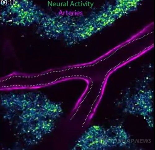신경혈관 접합
