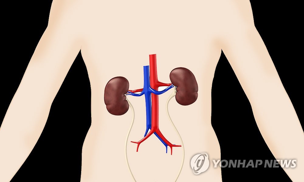 신장질환(일러스트)