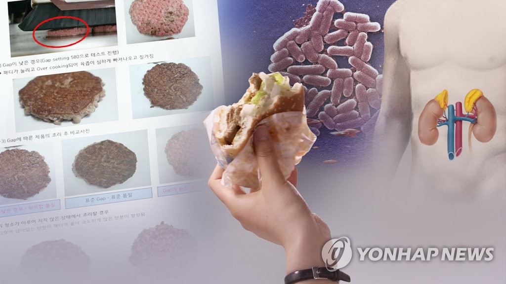 '햄버거병' 용혈성요독증후군 (CG)