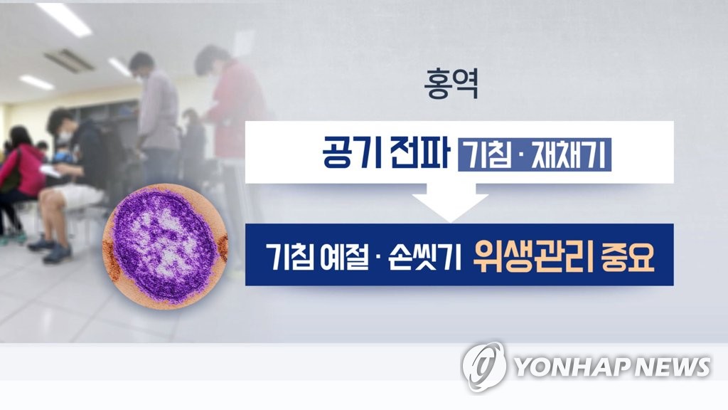 홍역 예방방법(CG)
