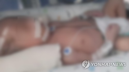 부산 신생아 의식불명 사건 관련 산부인과 병원장·간호사 입건