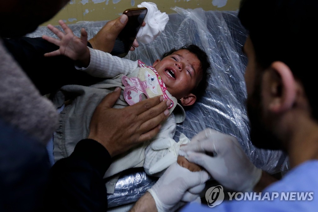 이스라엘 공습으로 부상한 팔레스타인 아이.