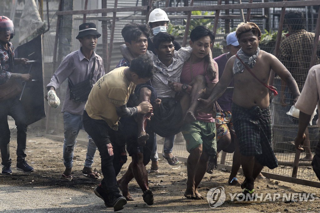 쿠데타 규탄 시위 도중 부상한 미얀마 시민
