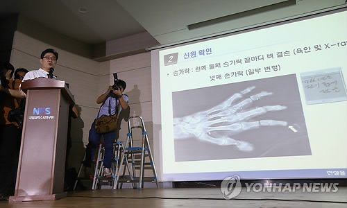 손가락 뼈 결손으로 유병언 확인