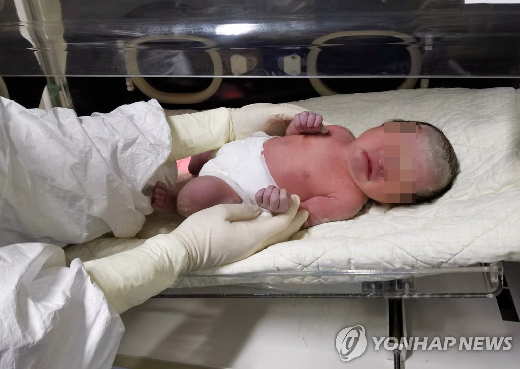 무사히 출산한 신종 코로나 감염 중국 산모