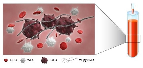 Doctors successfully detect cancer cells in blood