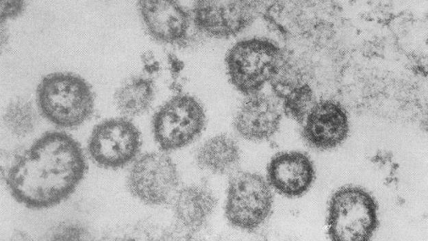 세계보건기구(WHO)가 공개한 아프리카 시에라리온에서 발견된 아레나 바이러스 샘플. [브라질 뉴스포털 UOL]