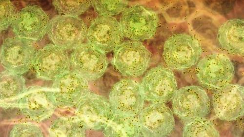 염증 신호를 받아 항체(갈색)를 만드는 B세포(녹색) 