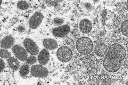 원숭이두창 바이러스 입자 현미경 이미지