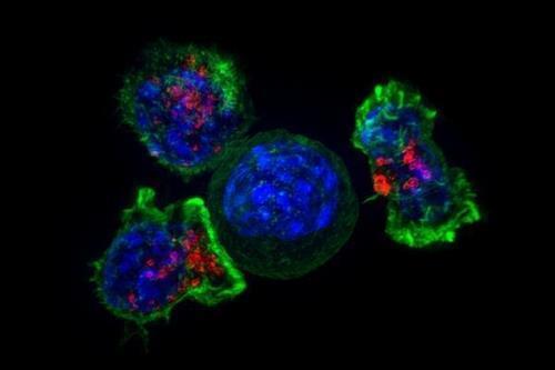 암세포(청색)를 둘러싼 킬러 T세포(녹색·적색) 