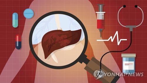 "간암 환자 수술 전후 방사선 치료하면 생존율·완치율↑"