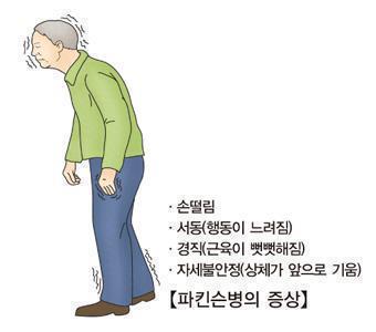 파킨슨병