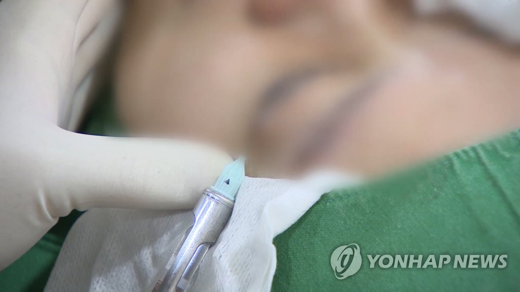라식수술