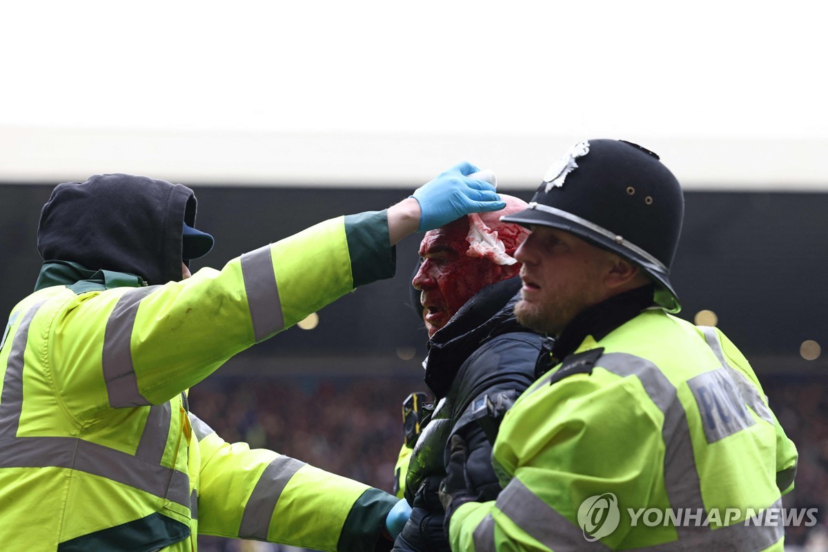 머리에 상처를 입은 관중이 경찰의 보호를 받으며 경기장을 빠져 나가는 모습.